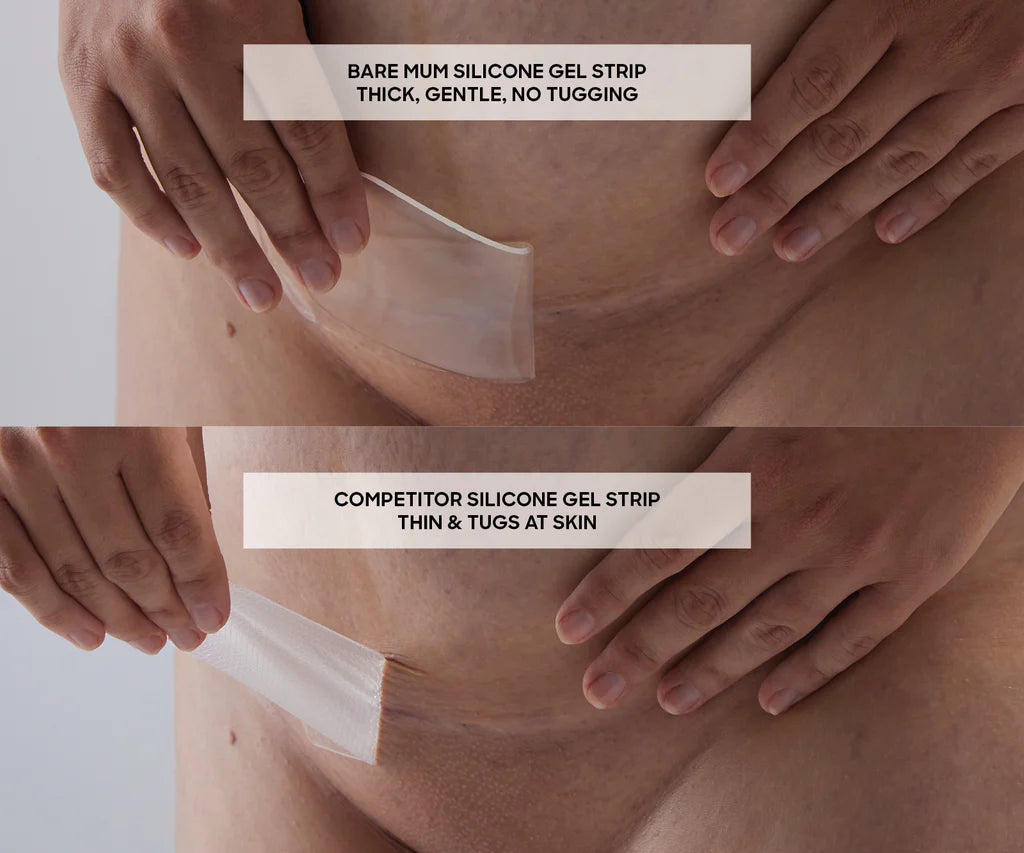 Bare Mum Silicon Gel Scar Strips Washable & Reusable